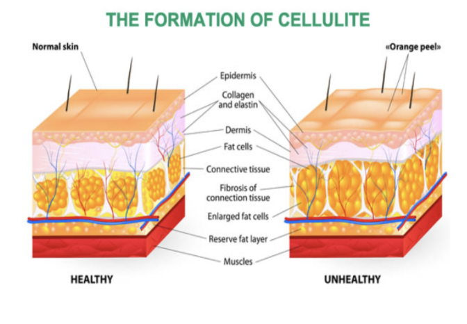 cellulite-formation (1) Citrus Mist Spray